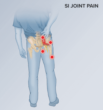 Illustration of a person from behind, touching their lower back and pelvis, with red circles highlighting areas of pain near the sacroiliac (SI) joint. Text reads SI JOINT PAIN.